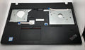 Lenovo ThinkPad E570 Palmrest Housing Replacement