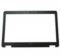 Dell Precision M2800 Front Bezel Housing Replacement